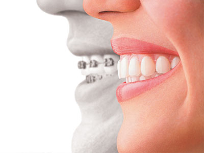 The Center for Advanced Dental Care, PLLC | Dental Fillings, CEREC and Ceramic Crowns