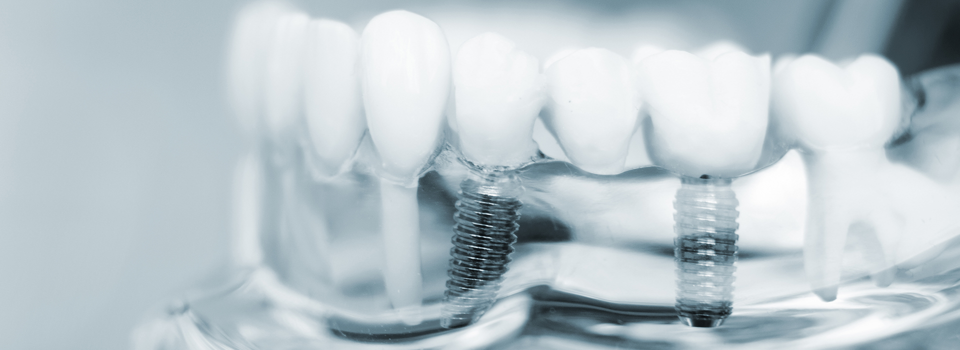 The Center for Advanced Dental Care, PLLC | Crowns, Emergency Treatment and Laser Dentistry