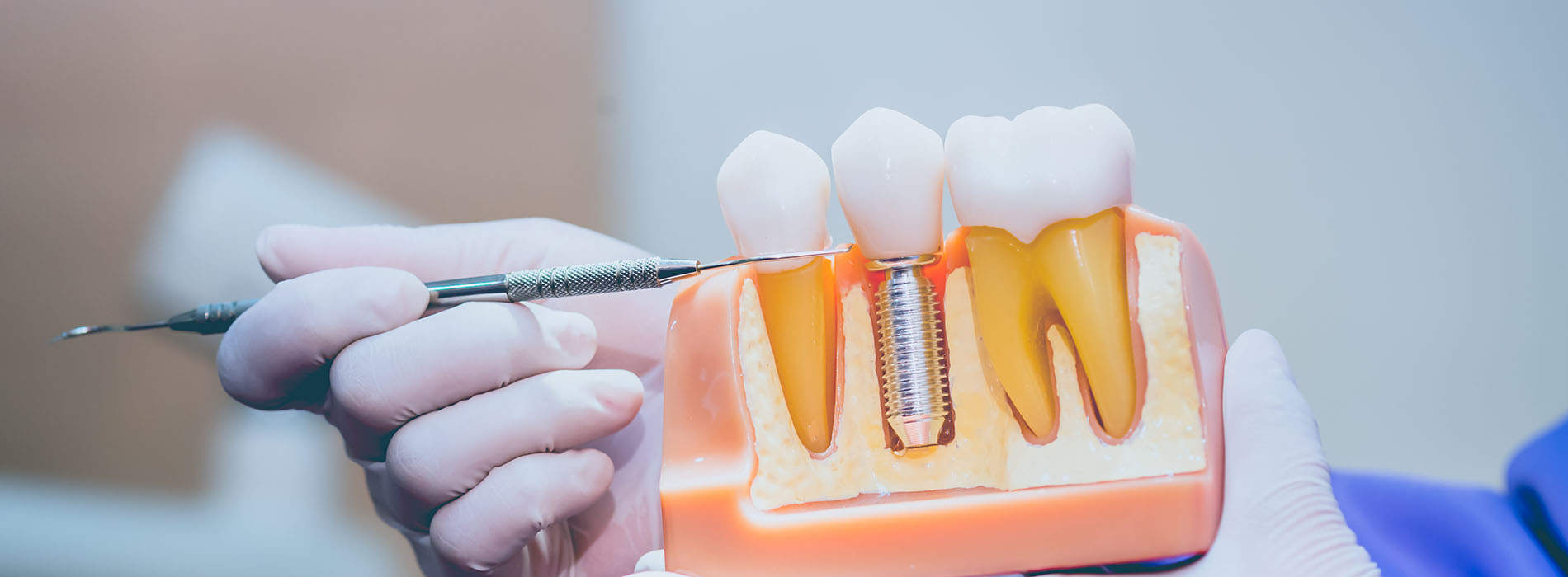 The Center for Advanced Dental Care, PLLC | Periodontal Treatment, Dental Fillings and Dental Cleanings